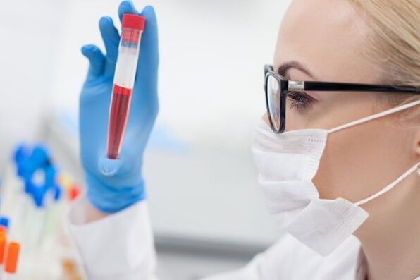 análisis de sangre para la hipertensión